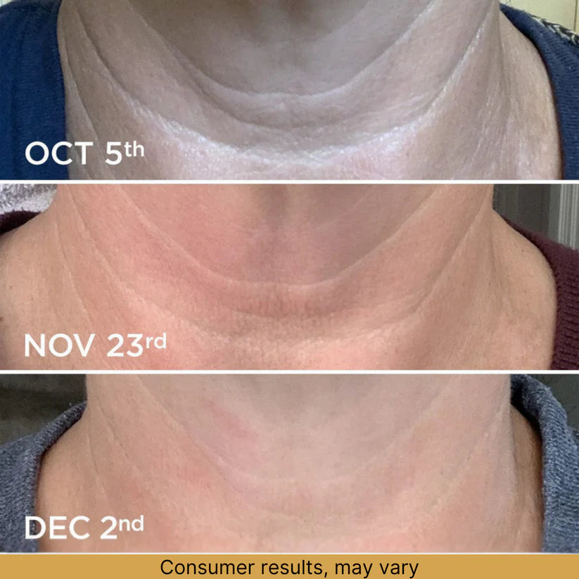 Pleral™ Firming Complex